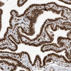 Immunohistochemical staining of human fallopian tube shows strong nuclear positivity in glandular cells.