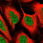 Immunofluorescent staining of human cell line U-2 OS shows localization to nucleoplasm.