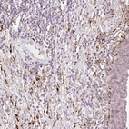 Anti-COL5A1 Antibody