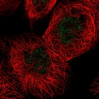 Immunofluorescent staining of human cell line A-431 shows localization to nucleoplasm.