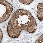 Immunohistochemical staining of human testis shows strong cytoplasmic positivity in cells in seminiferous ducts.