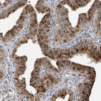 Immunohistochemical staining of human fallopian tube shows strong cytoplasmic positivity in glandular cells.