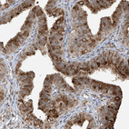 Anti-VMP1 Antibody