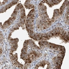 Immunohistochemical staining of human fallopian tube shows strong cytoplasmic positivity in glandular cells.