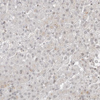 Immunohistochemical staining of human liver shows negative to very weak cytoplasmic positivity in hepatocytes.