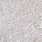 Immunohistochemical staining of human liver shows negative to very weak cytoplasmic positivity in hepatocytes.