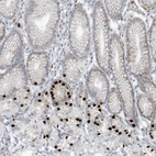 Immunohistochemical staining of human stomach shows strong nuclear positivity in a subset glandular cells.
