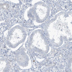 Anti-PAX6 Antibody