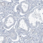 Immunohistochemical staining of human endometrium shows no positivity as expected.
