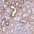 Anti-VDAC1 Antibody
