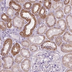 Anti-VDAC1 Antibody