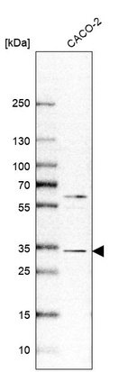 Western blot analysis in human cell line CACO-2.