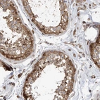Anti-MKL1 Antibody