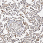 Immunohistochemical staining of human lung shows moderate cytoplasmic positivity in macrophages.