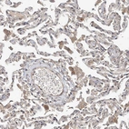Immunohistochemical staining of human lung shows moderate cytoplasmic positivity in macrophages.