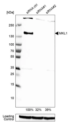 Western blot analysis in U-251MG cells transfected with control siRNA, target specific siRNA probe #1 and #2, using Anti-MKL1 antibody. Remaining relative intensity is presented. Loading control: Anti-GAPDH.
