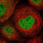 Immunofluorescent staining of human cell line A-431 shows localization to nucleoplasm.
