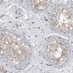Anti-HEATR6 Antibody