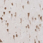 Immunohistochemical staining of human hippocampus shows strong nuclear and cytoplasmic positivity in pyramidal cells.