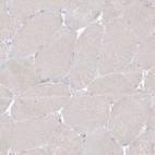 Immunohistochemical staining of human skeletal muscle shows no positivity in myocytes as expected.