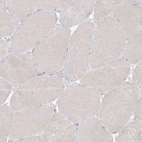 Immunohistochemical staining of human skeletal muscle shows no positivity in myocytes as expected.