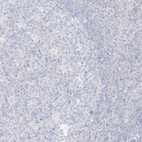 Immunohistochemical staining of human tonsil shows no positivity in germinal center cells as expected.