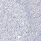 Immunohistochemical staining of human tonsil shows no positivity in germinal center cells as expected.
