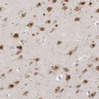 Immunohistochemical staining of human cerebral cortex shows strong nuclear and cytoplasmic positivity in neurons.
