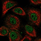 Immunofluorescent staining of human cell line A549 shows localization to nucleoplasm.