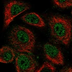 Immunofluorescent staining of human cell line A549 shows localization to nucleoplasm.