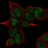 Anti-ANGEL2 Antibody