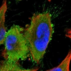 Immunofluorescent staining of human cell line U-251 MG shows localization to plasma membrane.