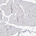 Immunohistochemical staining of human skeletal muscle shows moderate nuclear positivity in myocytes.