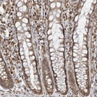 Immunohistochemical staining of human rectum shows moderate nuclear/cytoplasmic positivity in lymphoid cells and glandular cells.