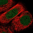 Immunofluorescent staining of human cell line A-431 shows localization to nucleoplasm & nuclear membrane.