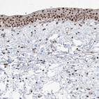 Immunohistochemical staining of human urinary bladder shows strong nuclear positivity in urothelial cells.