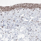 Immunohistochemical staining of human urinary bladder shows strong nuclear positivity in urothelial cells.