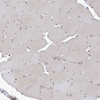 Immunohistochemical staining of human skeletal muscle shows moderate to strong nuclear positivity in a subset of myocytes.
