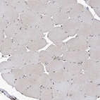 Immunohistochemical staining of human skeletal muscle shows moderate to strong nuclear positivity in a subset of myocytes.