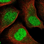 Immunofluorescent staining of human cell line U-2 OS shows localization to nucleoplasm.