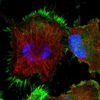 Immunofluorescent staining of human cell line U-251 MG shows localization to plasma membrane.