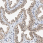 Anti-TASP1 Antibody