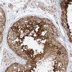 Immunohistochemical staining of human testis shows strong cytoplasmic positivity in cells in seminiferous ducts.