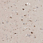 Immunohistochemical staining of human cerebral cortex shows moderate to strong cytoplasmic positivity in neurons.