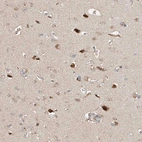 Immunohistochemical staining of human cerebral cortex shows moderate to strong cytoplasmic positivity in neurons.
