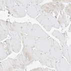 Immunohistochemical staining of human skeletal muscle shows no positivity in myocytes as expected.