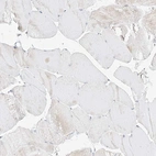 Immunohistochemical staining of human skeletal muscle shows no positivity in myocytes as expected.