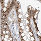 Immunohistochemical staining of human colon using Anti-LRRC59 antibody HPA030827.