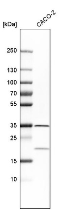 Western blot analysis in human cell line CACO-2.