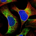 Immunofluorescent staining of human cell line U-2 OS shows localization to endoplasmic reticulum.